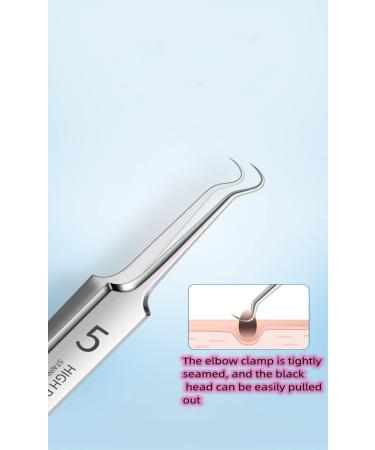 Professional Blackhead Remover Extractor Kit - Acne & Whitehead Removal Tool - Buy Online on GoSupps.com
