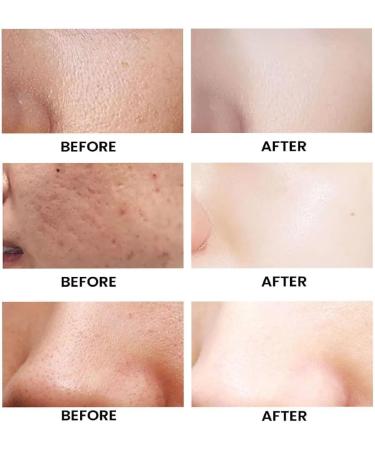  HONGYOU Egg White Soap 2024 Handmade Facial Soap Egg White Collagen Body Soap Egg White Moisturizing Soap for Face Egg Essential Oil Soap - Buy Online on GoSupps.com