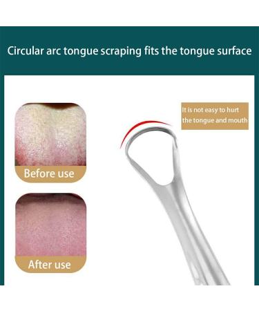 AUklOPVZZ 3pcs Tongue Scraper Set - Fresher Breath & Kid-Friendly Oral Care Tool | Durable & Effective Cleaning Plates - Buy Online on GoSupps.com