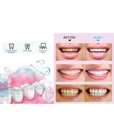 Nicotinamide Whitening Toothpaste niacinamide toothpaste Remove Tooth Stains and Whitening Complete Care Toothpaste Fresh Breath Toothpaste Remove Tooth Stains (1) - Buy Online on GoSupps.com