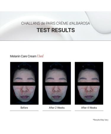 PARIS Cr me d Albarosa Excellence Niacinamide Brightening Cream for Even Skin Tone | Dark Spot Care, Korean Skincare, 1.05 fl oz (30 ml) (DARK SPOT CORRECTOR, 1.05 fl oz) DARK SPOT CORRECTOR 1.05 Fl Oz (Pack of 1) - Buy Online on GoSupps.com