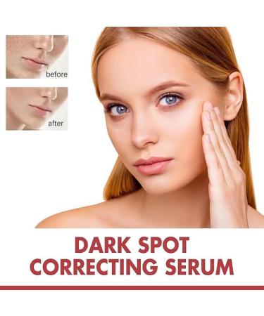  2Pcs Dark Spot Correcting Serum 10% Niacinamide+ 4% Tranexamic Acid Serum Ceramide Hyaluronic Acid Vitamin B12 natural color for Sensitive skin Fragrance-Free For Women Skin Care Serum 30ml/1fl.oz - Buy Online on GoSupps.com