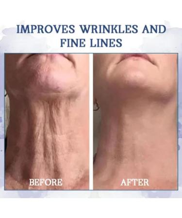 Kwiphiny Fubsta Advanced Firming & WrinkleReducing Cream Fubsta Skin Firming Rejuvenating Serum Fubsta Skin Firming Rejuvenating Cream AntiWrinkle Firming Multipurpose Cream for All Skin Types 3PCS - Buy Online on GoSupps.com