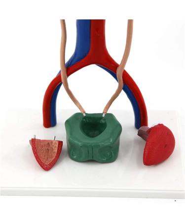 1 to 1 Size Urinary System Model Renal Arteriovenous Bladder-4 Parts- Dissected Structure of Kidney-Internal Structure of Bladder  - Buy Online on GoSupps.com