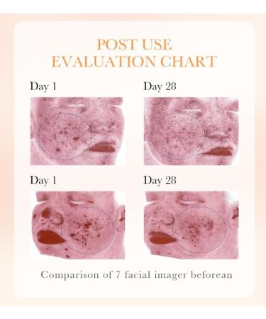 Crema carotonee para las manchas 30G Carotonee cream for Face & Body Corrector de manchas oscuras de Caroteno Face Moisturizer Cream - Buy Online on GoSupps.com