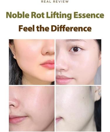 Papa Recipe Noble Rot Lifting Essence 200ml - Deep Moisturizing Korean Essence Toner for Sensitive Skin - Buy Online on GoSupps.com