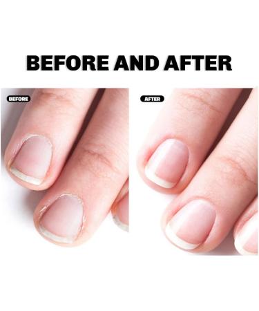 2PCS Finger Edge Oil Cuticle Barb Repair Finger Care Botanical Oil - Buy Online on GoSupps.com