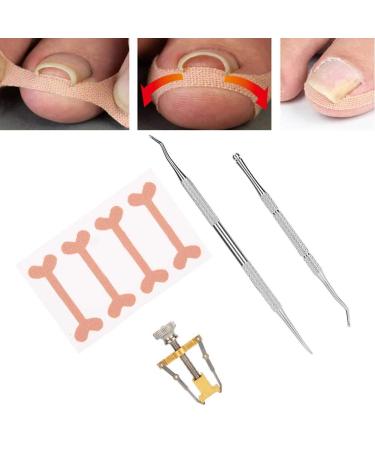 Tool set for correction of the toenail including embodied toened nail corrector.The toenail voter and the toenail file is made of steel