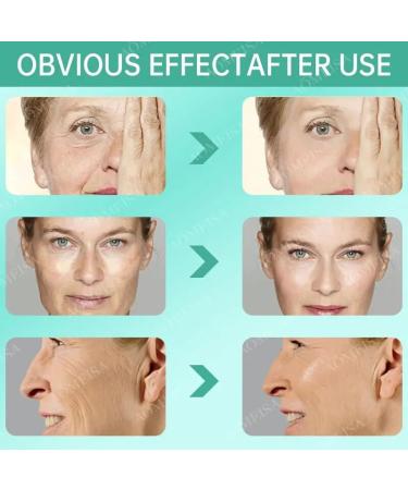 AOMEISA Anti-Acne Facial Serum Rejuvenate Oily Acne-Prone & Sensitive Skin International Shipping Available - Buy Online on GoSupps.com