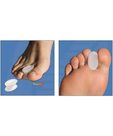 4x Hallux Valgus Gel Toe Spreader Kit - Effective Toe Spacer & Straightener for Men & Women - International Shipping Available - Buy Online on GoSupps.com