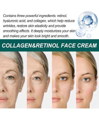 Collagen and Retinol Face Cream - Anti-Aging Hydrating Moisturizer with Hyaluronic Acid Vitamin E & Aloe Vera for Youthful Skin - 50g - Buy Online on GoSupps.com