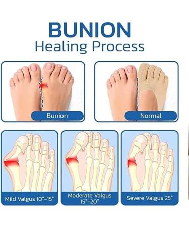 Projoint Antibunions Health Socks for Bunion Relief - 5 Pairs - Buy Online on GoSupps.com