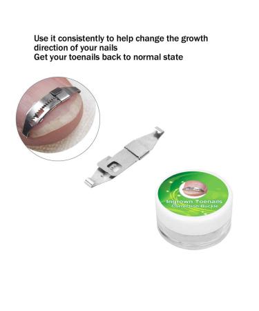 Ingrown Toenail Treatment Kit for Pain Relief - Paronychia Corrector Tool Set for Salon and Home Use - Buy Online on GoSupps.com