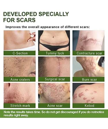 Proregen Medical Grade Scar Removal Spray - Advanced Serum for All Types of Scars (1PCS) - Buy Online on GoSupps.com
