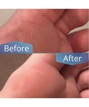 Buy Premium Honey Balm from the Netherlands - Pedicure Quality for Dry Skin Healing & Anti-Inflammatory with Pure Honey & Marigold - Buy Online on GoSupps.com