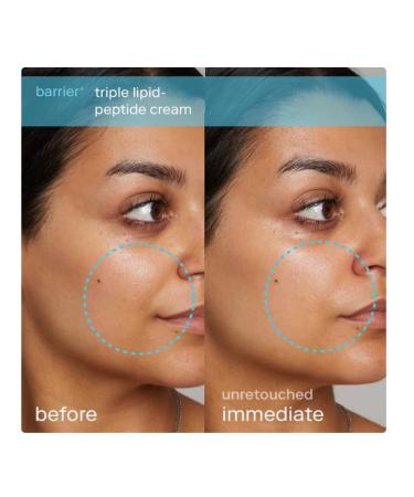 Skinfix Barrier+ Triple Lipid-Peptide Refillable Face Cream 1.7 oz - Hydrating Skin-Loving Formula for All Skin Types | Shop Internationally - Buy Online on GoSupps.com