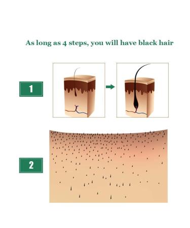 5 Pack Hair Growth Serum with Ginger Biotin for Men and Women - Prevent Hair Loss, Stimulate Regrowth, Strengthen and Lengthen Hair - Natural Formula for Thicker Strands - Buy Online on GoSupps.com