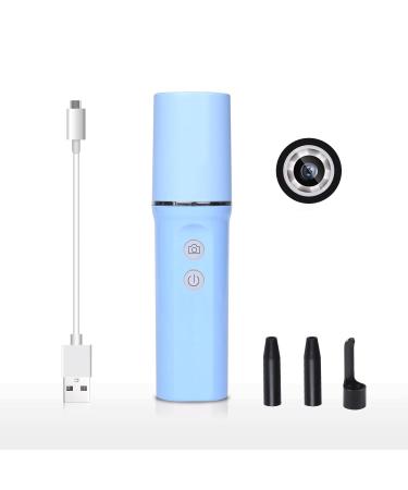 Marycan Ear Wax Removal Tool 720P Ear Wax Remover Tool WiFi HD Ear Camera 6 Low-Temp LED Lights Ear Cleaner with LCD Screen for Kids Adults (Color : Blue)