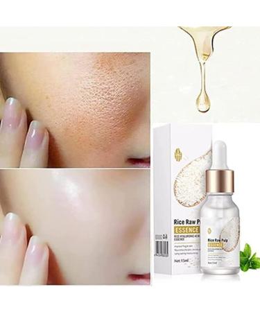 Rice Cream for Face Face Spot Cream Rice Cream for Facial Skin and Closed Pores Remove Spots Deep Moisturizing Facial Serum Essence (2pcs) - Buy Online on GoSupps.com