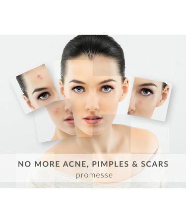 Promesse Acne Control Facial Cleanser - Anti-Aging Exfoliating Wash with Glycolic & Salicylic Acid Grapefruit-Scented Made in USA Organic & Natural Ingredients - Buy Online on GoSupps.com