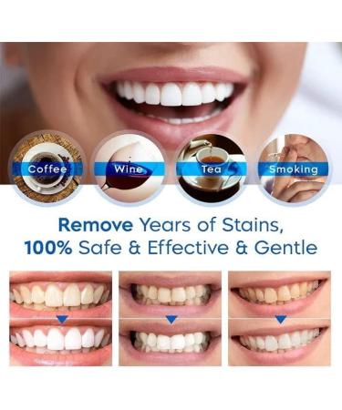 Teeth Whitening Essence Pen | Stain Remover for Brighter Teeth - Buy Online on GoSupps.com