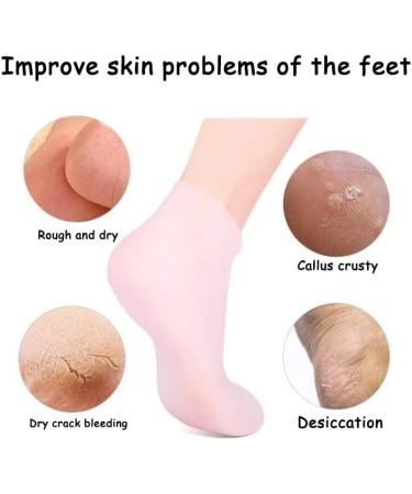 Braleto Silicone Socks for Women - 3 Pairs of Moisturizing Foot Spa Gel Socks for Cracked Dry Feet & Rough Skin Care - Buy Online on GoSupps.com