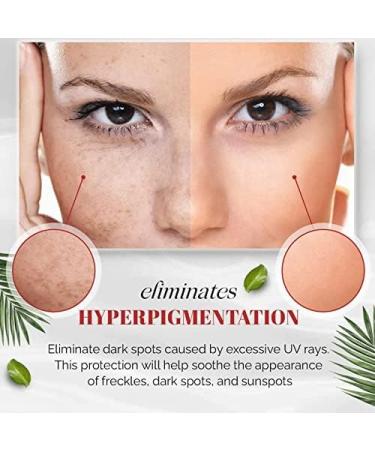 VoaiBekt Crema para Manchas Oscuras en La Cara Cremas para Quitar Manchas de La Cara - Buy Online on GoSupps.com