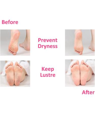 MICPANG Gel Heel Protectors for Plantar Fasciitis & Cracked Heel - Moisturizing Cushion Pads for Women and Men - Buy Online on GoSupps.com
