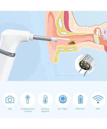 Electric Ear Wax Removal Kit - HD 200W Wireless Otoscope Camera with 6 LED for Kids & Adults - Optimal Ear Cleaning Solution - Buy Online on GoSupps.com