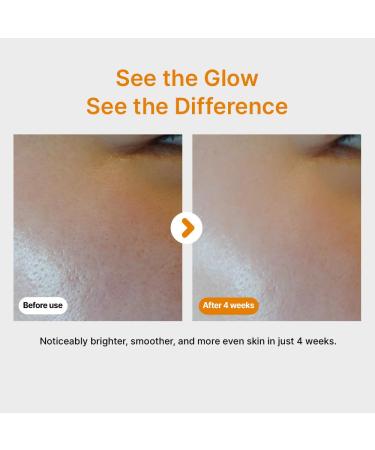 SUMSAE Pure Vitamin C Serum - Best Korean Skincare with Vitamin 10.5%, No Added Water, Special Airless Pump, Brightening and Firming Skin, Improving Uneven and Dull Skin Tone, 30ml/1.01fl.oz. - Buy Online on GoSupps.com