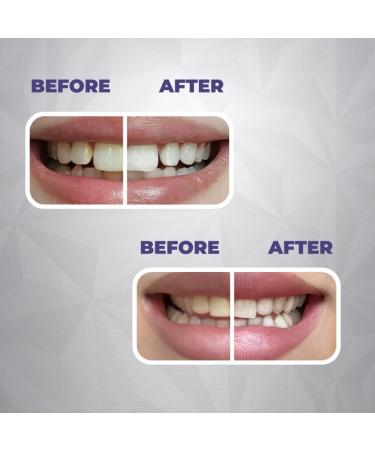 Gentle Whitening & Remineralization Teeth Strips | Helps Your Teeth gets Stronger | 14-Treatment Kit for Sensitive Teeth | Peroxide-Free Formula with Hydroxyapatite Papain & Coconut Oil (28 Strips) - Buy Online on GoSupps.com