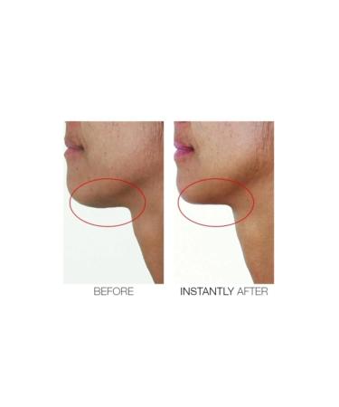 Mirenesse Cosmetics Chin Tuck V Shape Lifting Serum - Lift and Firm Your Jawline - Buy Online on GoSupps.com