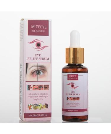 Chalazion Eye Treatment & Blepharitis Relief - 30ml Under Eye Serum for Dark Circles Puffiness & Moisturizing Eyelids - Buy Online on GoSupps.com