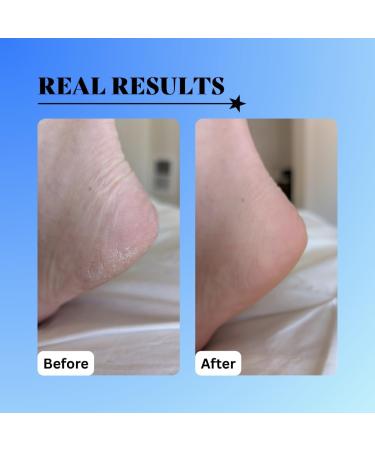 10% Glycolic Exfoliating Treatment Tonic (1oz) 1 Ounce (Pack of 1) - Buy Online on GoSupps.com