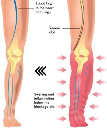 TTBN Lymph Drainage Magnetic Bracelet Magnetic to Relieve Arthritis Pain Promotes Blood Circulation Relieves Muscle Pain and Swelling Health Titanium Bracelets for Men and Women (Black) - Buy Online on GoSupps.com