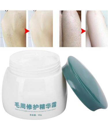 Professional Keratosis Hair Cream Soothing Chicken Skin Treatment Body Care Cream Pure Natural Plant Ingredients Softens Excess Aged Skin - Buy Online on GoSupps.com