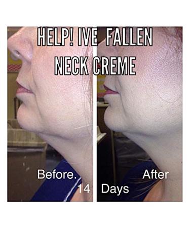 Fleur De Vie Cosmetics NEW and IMPROVED Help I've Fallen Firming Neck Treatment- - Buy Online on GoSupps.com