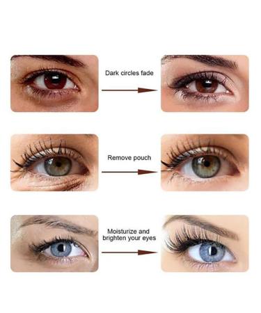 Snake Venom Eye Cream - Under Eye Treatment for Dark Circles, Bags, and Wrinkles (3PCS) - Buy Online on GoSupps.com