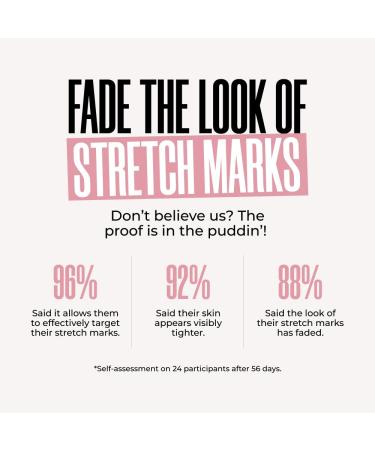 MA LYS Cosmetics GET-SPRUNG Enriched Stretch Mark Oil - Reduce Stretch Marks & Improve Skin Tone - International Shipping Available - Buy Online on GoSupps.com