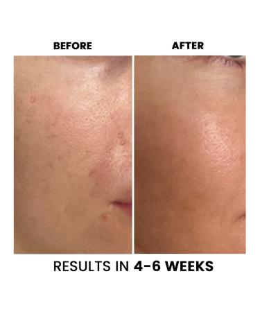 Conatural Vitamin-C Super Activs Skin Serum | Brightening & Revitalizing | 30ml - Best for Dull Skin - Buy Online on GoSupps.com