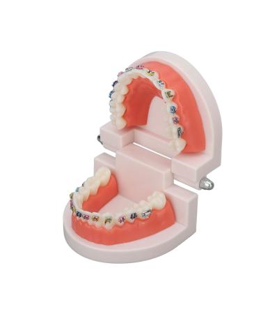 Orthodontic tooth model with orthodontic metal brackets for the teaching research laboratory