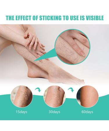 Varicose Veins Patch - Effective Treatment for Spider Veins | 12 Pcs | Fast International Shipping - Buy Online on GoSupps.com