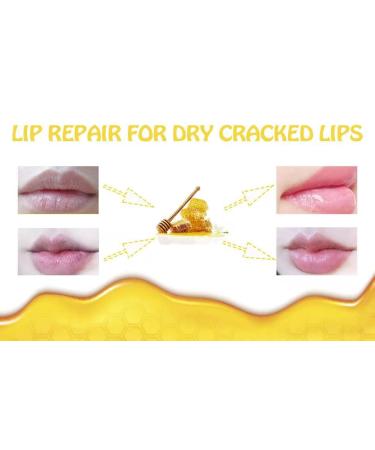 Honey & Strawberry Lip Care Set - Exfoliating Lip Masks for Dry Lips, Moisturizing Balm with Brush, Anti-Wrinkle Formula for Aging Lips - Buy Online on GoSupps.com