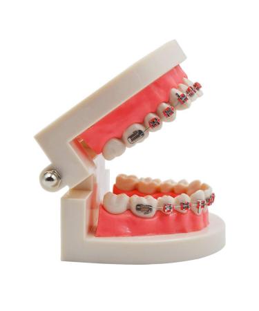 KFO Tooth Model Standard Tooth Teaching Malocclusion KFO Teeth Model with Brackets Archwire Tools