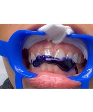 LaserGlow Purple Toothpaste | #1 Color Corrector for Whitening & Stain Removal | Best Purple Toothpaste for Yellow Tones - Buy Online on GoSupps.com