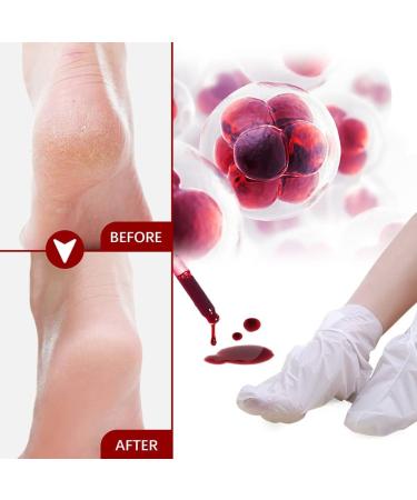 5 Pairs Moisturizing Foot Masks | Effective Corneal Remover Socks for Soft Smooth Feet - Buy Online on GoSupps.com