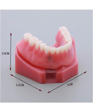 Fhuili Teeth Model for Education | Dental Implant Repair & Communication | Red Dentition Simulation Tool - Buy Online on GoSupps.com