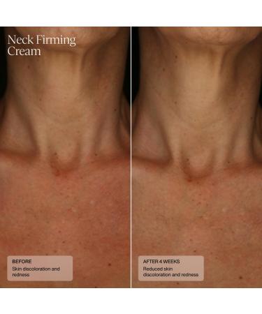 Buy Sent Neck Firming Cream - Advanced Anti-Aging Lift Cream with HSA Caffeine & Vitamin C | 1.7 Oz - International Shipping Available - Buy Online on GoSupps.com