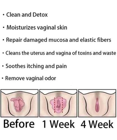 Shop Instant Anti-Itch Detox Capsules | Firming Repair & Natural Skin Relief - 8 Bag - Buy Online on GoSupps.com