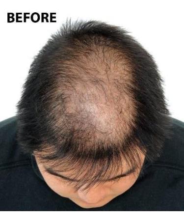 Super Million Hair - 15g Hair Fibres - No.67 Natural Blonde - Buy Online on GoSupps.com